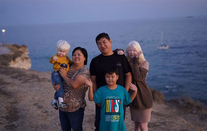 Це зображення має порожній атрибут alt; ім'я файлу 79eb7c4-albinos-family.jpg